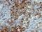 Nerve Growth Factor Receptor antibody, GTX34947, GeneTex, Immunohistochemistry paraffin image 