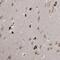 MLLT1 Super Elongation Complex Subunit antibody, NBP1-84840, Novus Biologicals, Immunohistochemistry paraffin image 