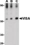 Mitochondrial Antiviral Signaling Protein antibody, NB100-80859, Novus Biologicals, Western Blot image 