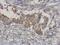 Mitogen-Activated Protein Kinase Kinase Kinase 3 antibody, GTX111498, GeneTex, Immunohistochemistry paraffin image 