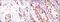 Protein Kinase, DNA-Activated, Catalytic Subunit antibody, GTX60401, GeneTex, Immunohistochemistry paraffin image 