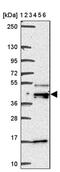DEK Proto-Oncogene antibody, PA5-63488, Invitrogen Antibodies, Western Blot image 