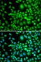 SET Domain Containing 5 antibody, 15-395, ProSci, Immunofluorescence image 