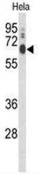 Lysophosphatidylcholine Acyltransferase 1 antibody, AP53189PU-N, Origene, Western Blot image 