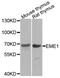 Essential Meiotic Structure-Specific Endonuclease 1 antibody, PA5-76372, Invitrogen Antibodies, Western Blot image 