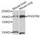 Platelet Derived Growth Factor Receptor Beta antibody, MBS127836, MyBioSource, Western Blot image 