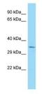 High Mobility Group 20B antibody, NBP1-98256, Novus Biologicals, Western Blot image 