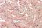 Secreted Frizzled Related Protein 1 antibody, AP22384PU-N, Origene, Immunohistochemistry paraffin image 