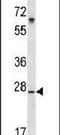 SRSF Protein Kinase 1 antibody, PA5-14486, Invitrogen Antibodies, Western Blot image 