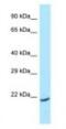 ADP Ribosylation Factor Like GTPase 1 antibody, NBP1-98485, Novus Biologicals, Western Blot image 