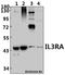 Interleukin 3 Receptor Subunit Alpha antibody, A04307-1, Boster Biological Technology, Western Blot image 