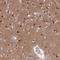 LysM Domain Containing 2 antibody, NBP1-82702, Novus Biologicals, Immunohistochemistry frozen image 