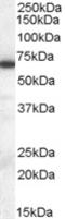 Ephrin A2 antibody, EB05528, Everest Biotech, Western Blot image 