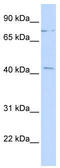 Zinc Finger Protein 302 antibody, TA345254, Origene, Western Blot image 