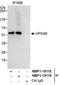 Vacuolar Protein Sorting 4 Homolog B antibody, NBP1-19118, Novus Biologicals, Immunoprecipitation image 