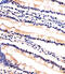 Ubiquitin Conjugating Enzyme E2 K antibody, MBS9213324, MyBioSource, Immunohistochemistry frozen image 