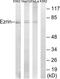 Ezrin antibody, LS-C198940, Lifespan Biosciences, Western Blot image 