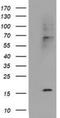 Cystatin SA antibody, NBP2-01747, Novus Biologicals, Western Blot image 
