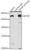 Mechanistic Target Of Rapamycin Kinase antibody, 18-651, ProSci, Immunoprecipitation image 