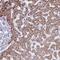 Ankyrin Repeat Domain 60 antibody, NBP2-32554, Novus Biologicals, Immunohistochemistry frozen image 