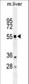 Autophagy Related 4D Cysteine Peptidase antibody, LS-C156602, Lifespan Biosciences, Western Blot image 