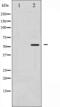 LCK Proto-Oncogene, Src Family Tyrosine Kinase antibody, abx012316, Abbexa, Western Blot image 