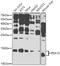 Proliferation And Apoptosis Adaptor Protein 15 antibody, GTX65994, GeneTex, Western Blot image 