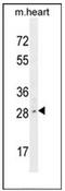 Limb And CNS Expressed 1 antibody, AP52500PU-N, Origene, Western Blot image 