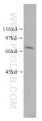 USH1 Protein Network Component Harmonin antibody, 51028-2-AP, Proteintech Group, Western Blot image 