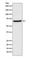 Chromatin Licensing And DNA Replication Factor 1 antibody, M01035, Boster Biological Technology, Western Blot image 