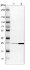 Protein NDRG3 antibody, NBP1-86054, Novus Biologicals, Western Blot image 