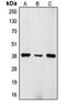 T Cell Receptor Beta Constant 1 antibody, orb215141, Biorbyt, Western Blot image 