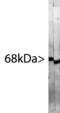 Neurofilament Light antibody, LS-C204557, Lifespan Biosciences, Western Blot image 