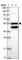 Coiled-Coil Domain Containing 149 antibody, HPA047913, Atlas Antibodies, Western Blot image 