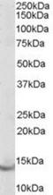 Parvalbumin antibody, NB100-1541, Novus Biologicals, Western Blot image 