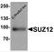SUZ12 Polycomb Repressive Complex 2 Subunit antibody, 7701, ProSci, Western Blot image 