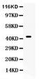 Cell Division Cycle 37 antibody, PB9574, Boster Biological Technology, Western Blot image 