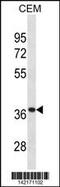 Alpha Tocopherol Transfer Protein antibody, 60-826, ProSci, Western Blot image 