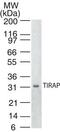 TIR Domain Containing Adaptor Protein antibody, MA1-41198, Invitrogen Antibodies, Western Blot image 