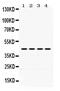 Actin Alpha 1, Skeletal Muscle antibody, PB9751, Boster Biological Technology, Western Blot image 
