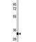 Lin-28 Homolog A antibody, F40207-0.4ML, NSJ Bioreagents, Western Blot image 
