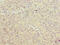 Phosphoglucomutase 2 Like 1 antibody, CSB-PA764776LA01HU, Cusabio, Immunohistochemistry paraffin image 