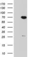 Protein Phosphatase 2 Regulatory Subunit B'Delta antibody, MA5-26647, Invitrogen Antibodies, Western Blot image 