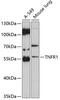 TNF Receptor Superfamily Member 1A antibody, 16-031, ProSci, Western Blot image 