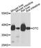 Ornithine Carbamoyltransferase antibody, A9834, ABclonal Technology, Western Blot image 
