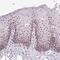 DExD-Box Helicase 50 antibody, NBP2-55077, Novus Biologicals, Immunohistochemistry frozen image 