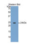 Insulin Like Growth Factor Binding Protein 6 antibody, LS-C294667, Lifespan Biosciences, Western Blot image 