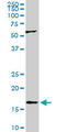 Ras Homolog, MTORC1 Binding antibody, LS-B12851, Lifespan Biosciences, Western Blot image 