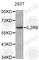 Interleukin 2 Receptor Subunit Beta antibody, A6207, ABclonal Technology, Western Blot image 