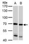 Afadin- and alpha-actinin-binding protein antibody, GTX104750, GeneTex, Western Blot image 